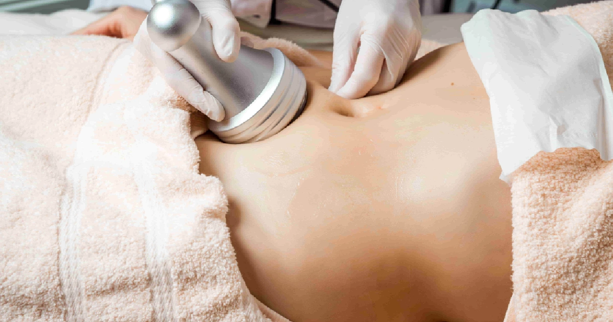Close-up of a body contouring treatment using a handheld device on a woman’s abdomen, performed by a professional wearing gloves in Kent, WA