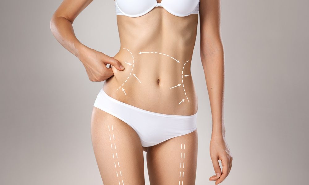Body-Contouring-By-R-And-R-Aesthetic-Medicine-in-Kent-WA